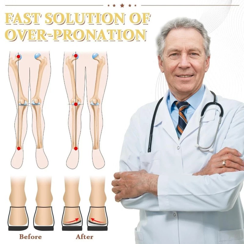 Corrective Insoles for Supination & Over-Pronation, Orthotics Medial & Latera... gallery
