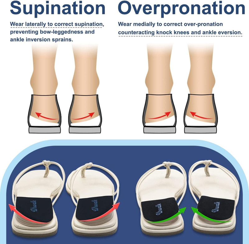 3 Layers Adjustable Supination & Over-Pronation Corrective Shoe Inserts, Medial gallery