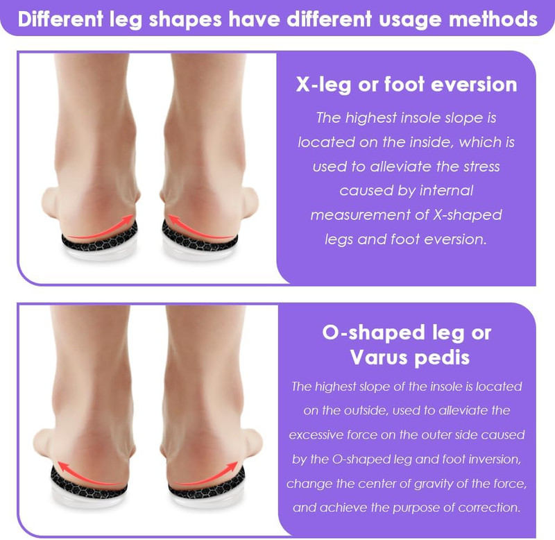 3 Layers Adjustable Supination Overpronation Insoles, Anti-Slip Medial Lateral H gallery