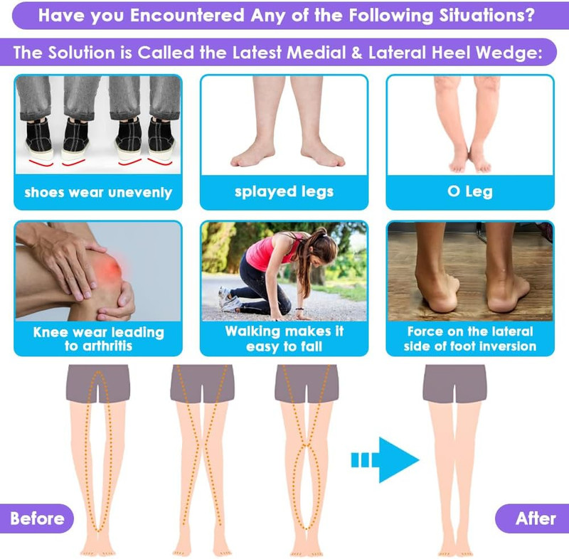 3 Layers Adjustable Supination Overpronation Insoles, Anti-Slip Medial Lateral H gallery
